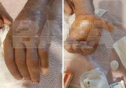 Буйный жеребец в Белгородской области искусал конюха и заразил его опасной инфекцией