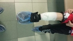 Стая бездомных собак напала на ребёнка под Белгородом 